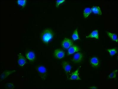 GDF5 antibody