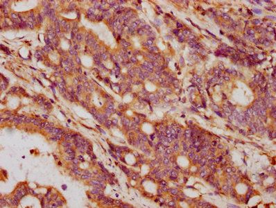 GDF5 Antibody