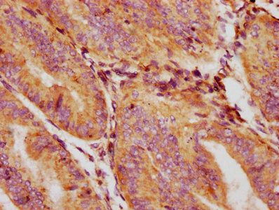 GDF5 Antibody