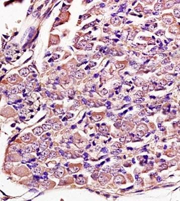 GDF9 Rabbit Polyclonal Antibody