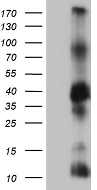GDI1 Antibody