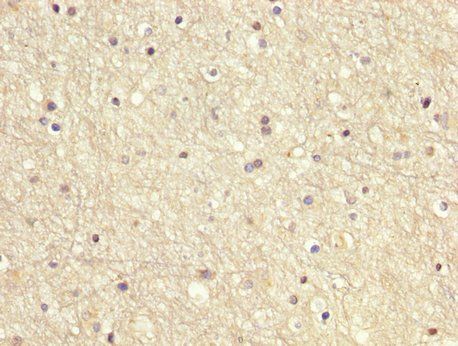 GDI1 Antibody