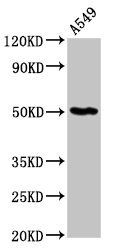 GDI1 Antibody