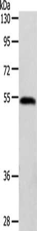 GDI1 Antibody