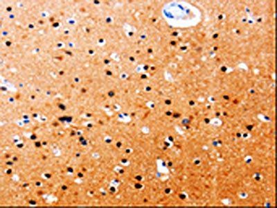 GDI1 Antibody
