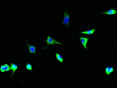TSTA3 Antibody