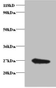 GDP-L-fucose synthase antibody