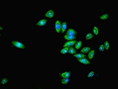 GDPD2 Antibody