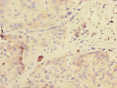 GDPD2 Antibody
