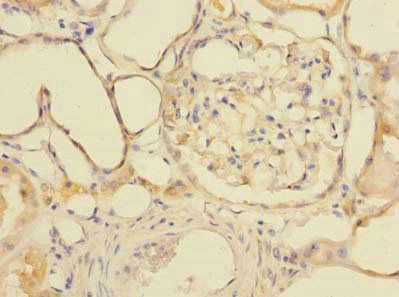 GDPD2 Antibody