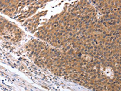 GEMIN2 Antibody
