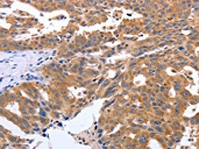 GEMIN2 Antibody