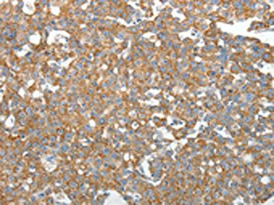 GEMIN2 Antibody