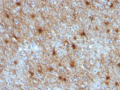 GFAP (Astrocyte & Neural Stem Cell Marker) Antibody