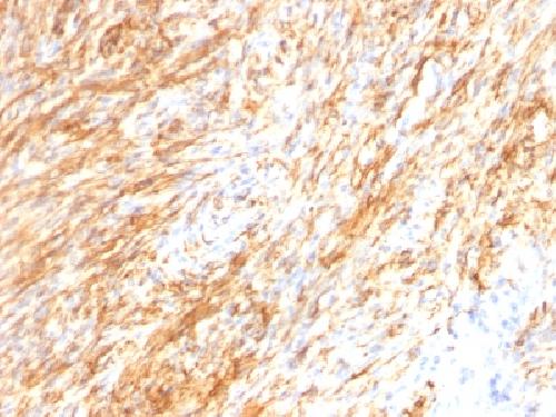 GFAP (Astrocyte & Neural Stem Cell Marker) Antibody