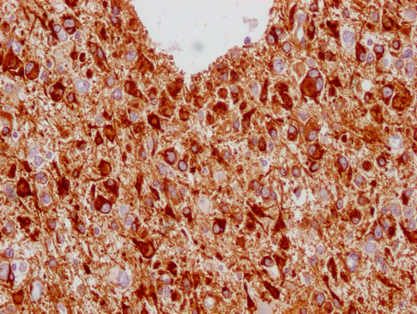 GFAP Monoclonal Antibody