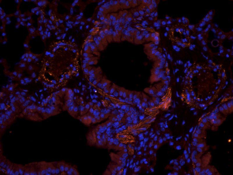 GFAP antibody