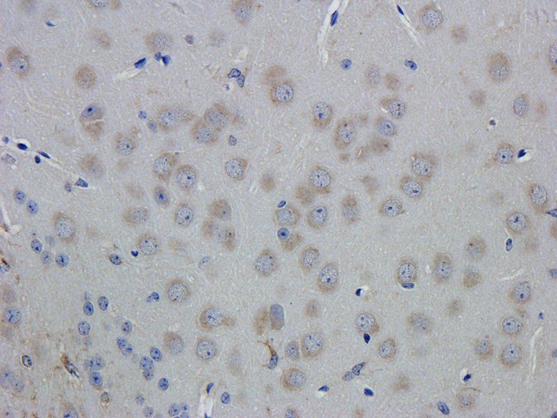 GFAP antibody