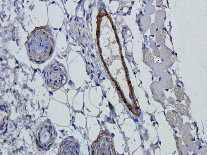 GFAP antibody