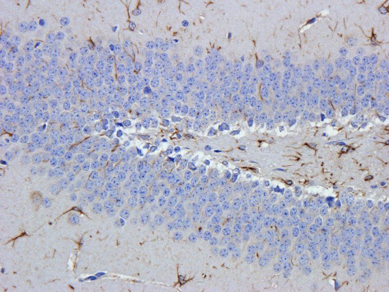 GFAP antibody