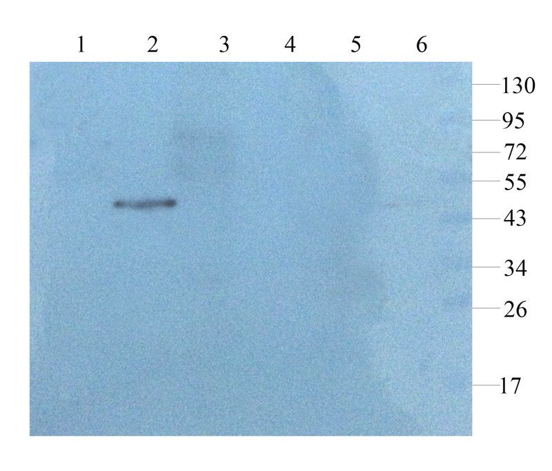 GFAP antibody