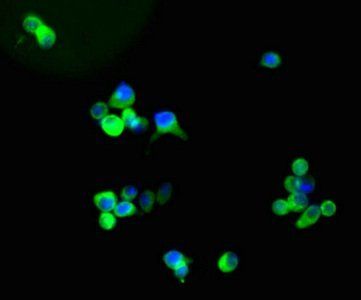 GFAP Monoclonal Antibody