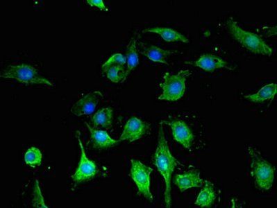 GFAP Monoclonal Antibody