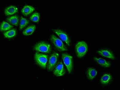 GFAP Monoclonal Antibody