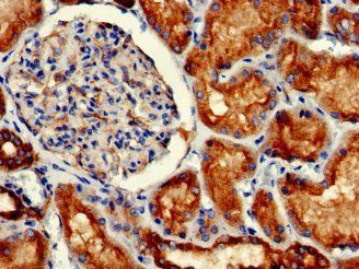 GFAP Monoclonal Antibody