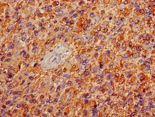 GFAP Monoclonal Antibody