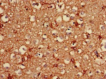 GFAP Monoclonal Antibody