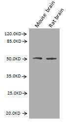 GFAP Monoclonal Antibody