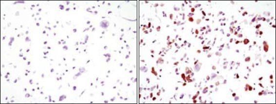 GFP Tag Antibody