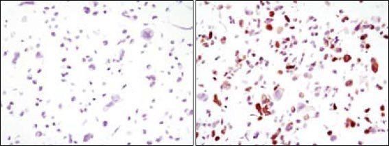 GFP Antibody