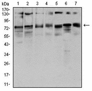 GFPT1 Antibody