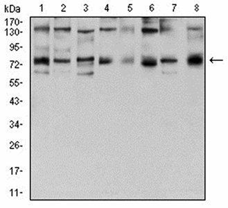 GFPT1 Antibody