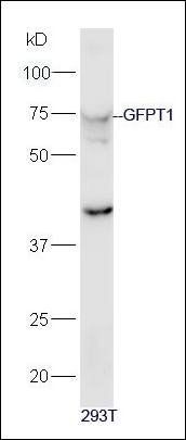 GFPT1 antibody