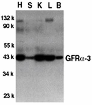 GFR alpha 3 Rabbit Polyclonal Antibody