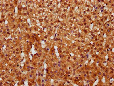 GGCT Antibody