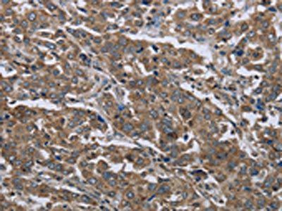 GGCX Antibody
