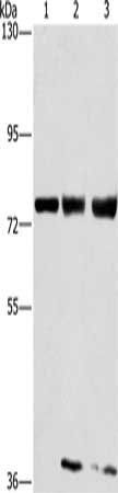 GGCX antibody