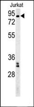 GGNBP2 antibody