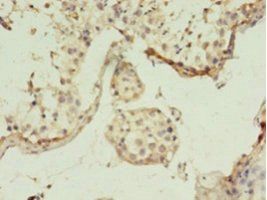GGPS1 Antibody