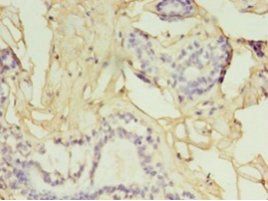 GGPS1 Antibody