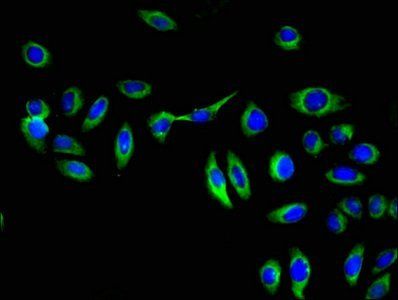 GGT1 Antibody