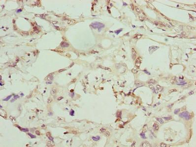 GGTLC1 Antibody
