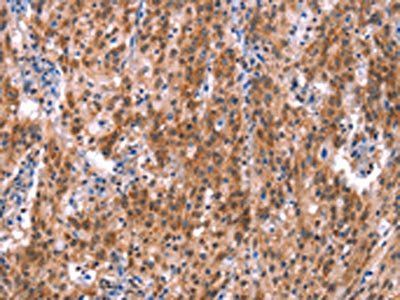 GH1 Antibody