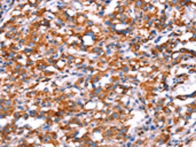 GH1 Antibody