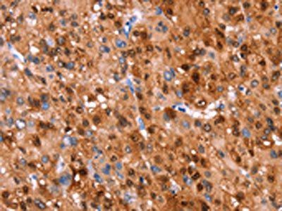 GH1 Antibody
