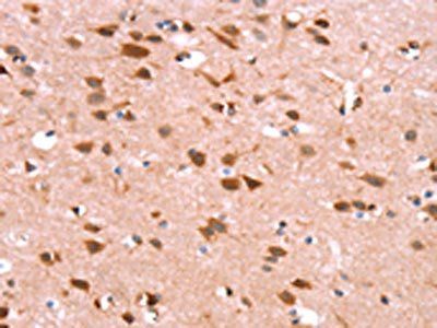 GH1 Antibody